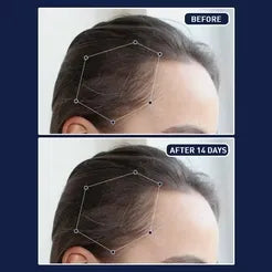 FEG- Hair Nourishing Spray (BUY 1 GET 1 FREE / RS- 1850)